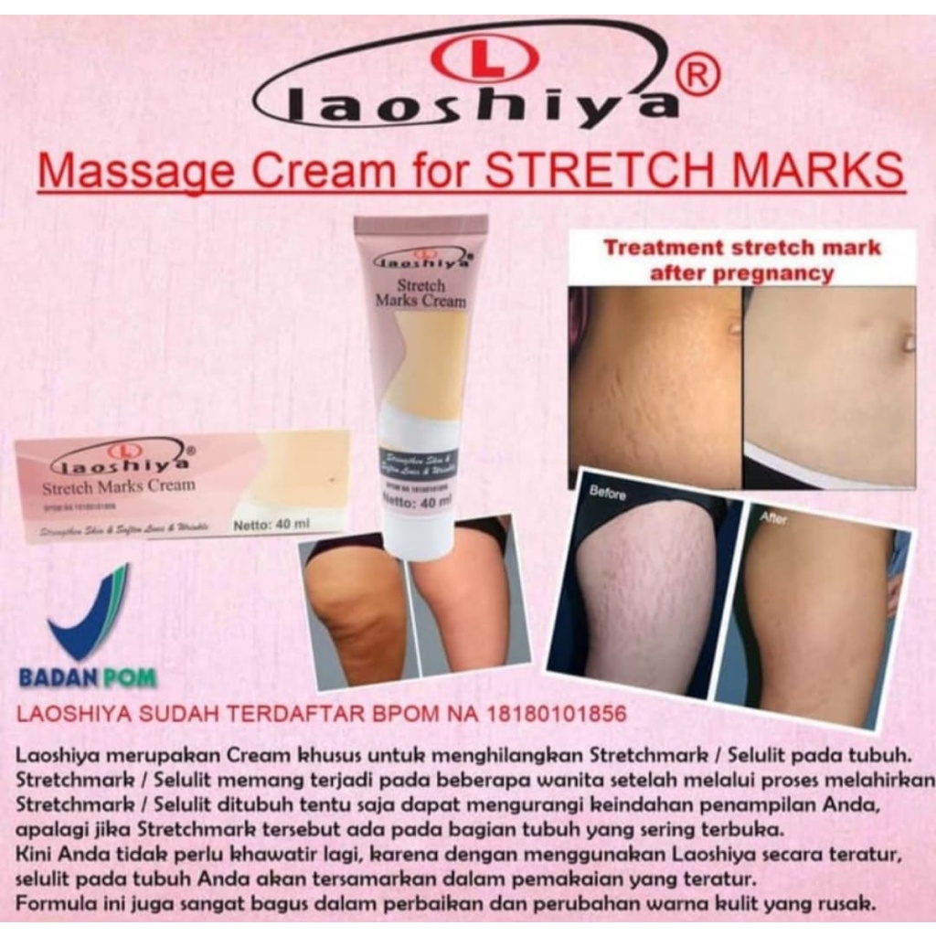 LAOSHIYA STRETCH MARKS CREAM ORIGINAL BPOM