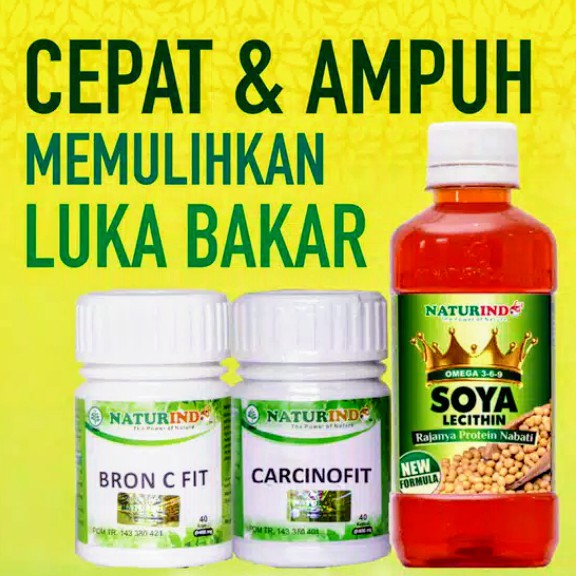 

Cepat & Ampuh Memulihkan Luka Bakar