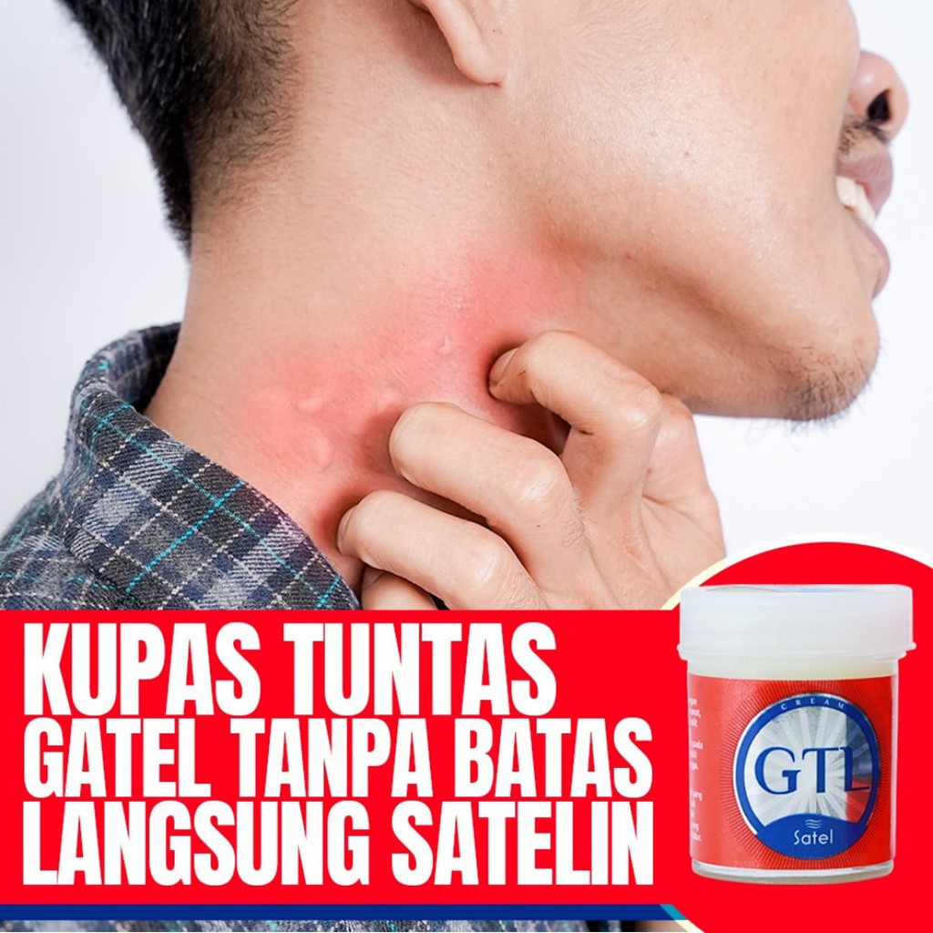 𝐀𝐠𝐞𝐧 𝐑𝐞𝐬𝐦𝐢 - 𝐒𝐚𝐭𝐞𝐥 𝐆𝐓𝐋 𝐎𝐫𝐢𝐠𝐢𝐧𝐚𝐥 | Solusi Gatel Alergi, Panu, Kadas, Kurap, Jamur, KutuAir, Bisul-5