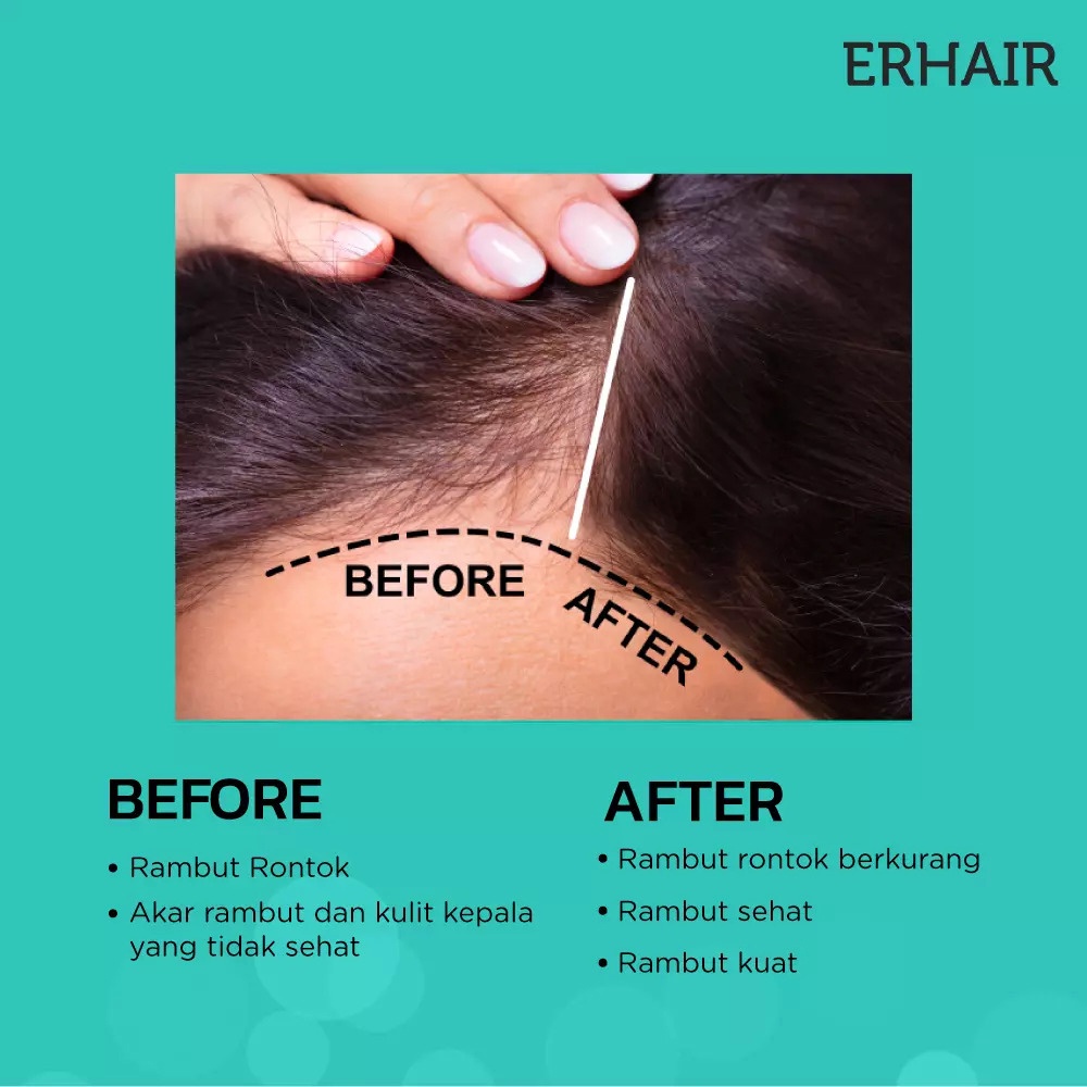 ERHAIR Hairgrow Tonic With Keratin Biotin 60ML - Solusi Rambut Rontok