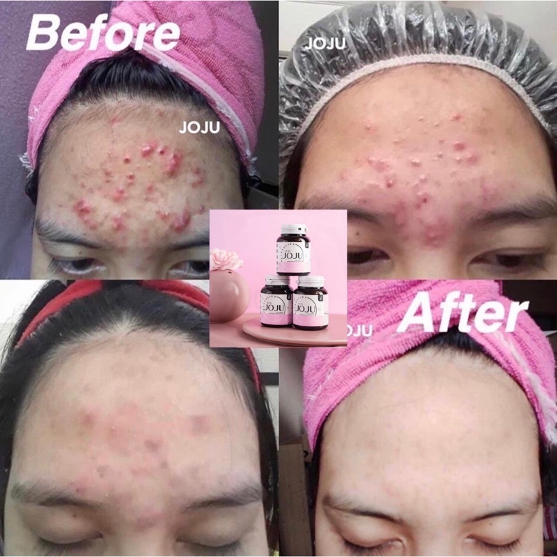 JOJU COLLAGEN ORIGINAL