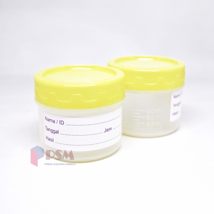 Jual Urine Container Non Steril 60ml Pot Urin Sputum Pot Shopee