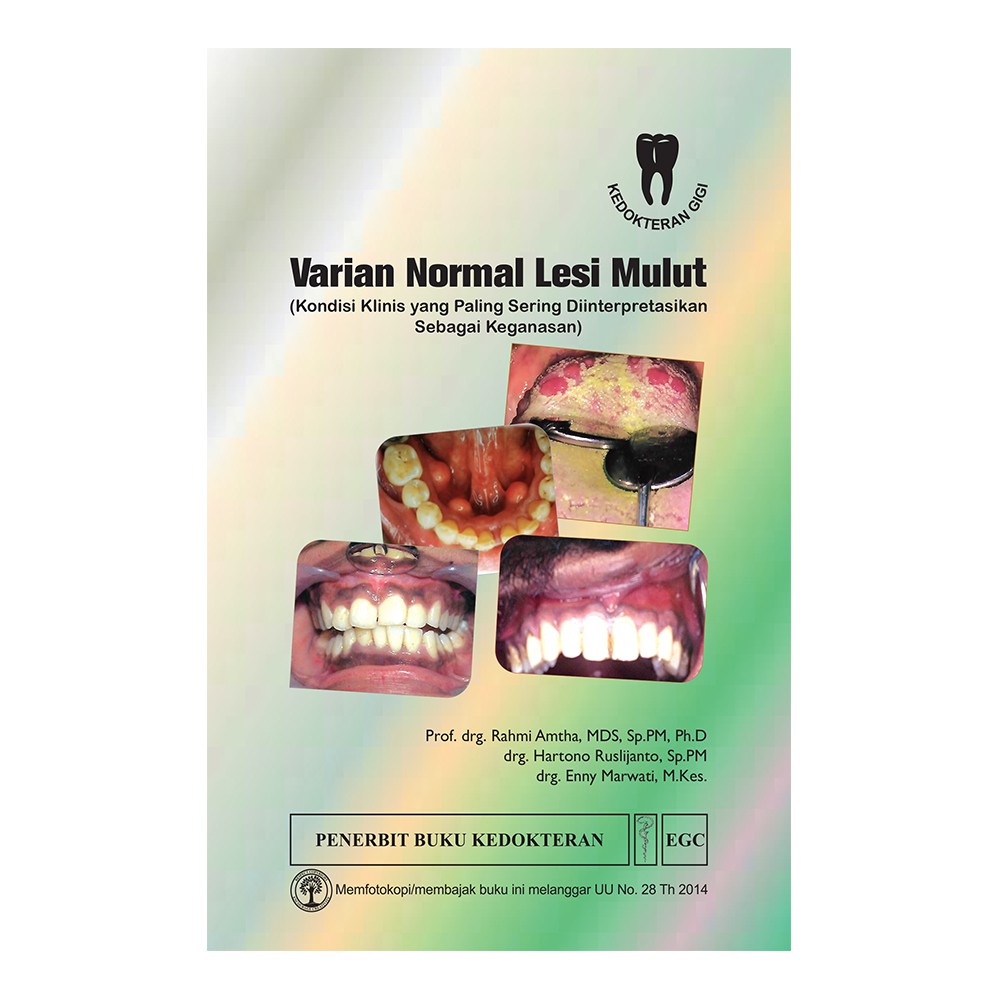 Varian Normal Lesi Mulut