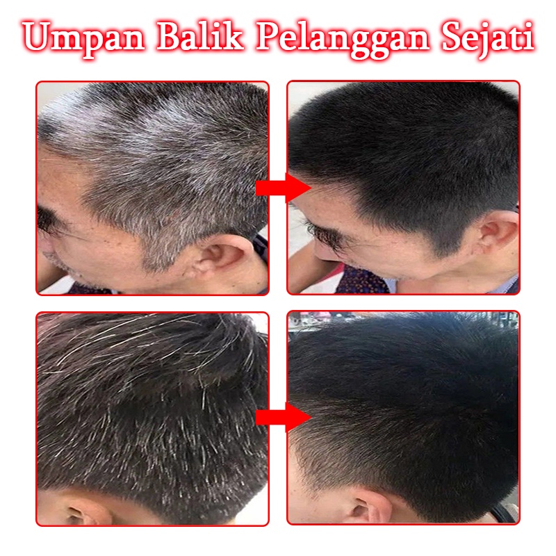 Hitam spray Hair growth serum spray Anti tonik rambut rontok Pertumbuhan rambut cepat 100ml Rambut putih tercepat di Indonesia menjadi rambut hitam Ekstrak tumbuhan alami Rambut hitam permanen