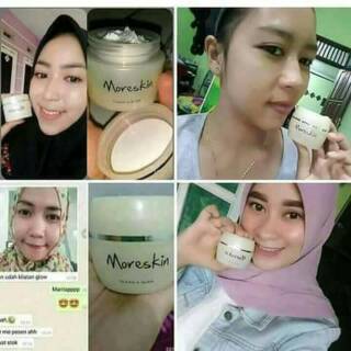 Untuk Theraskin Bumil Busui Dan