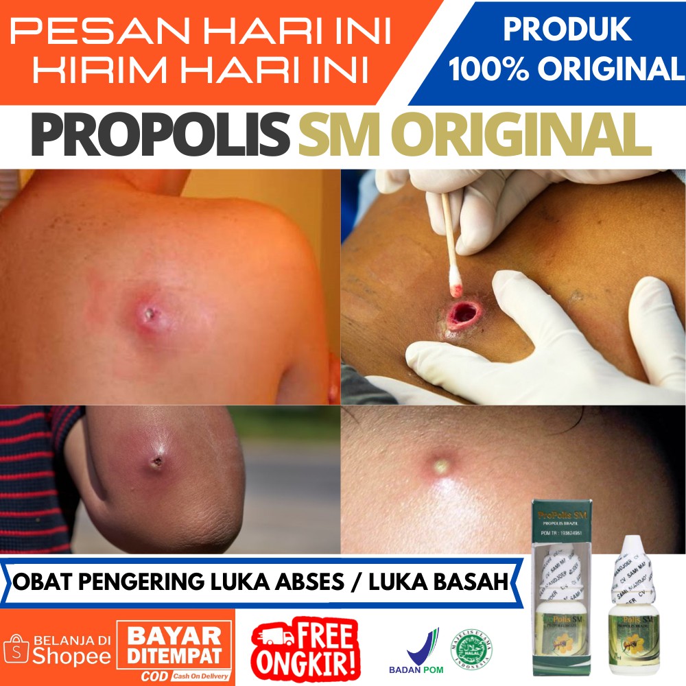 Obat Untuk Abses Kulit / Obat Pengering Luka Abses / Pengering Luka Bisul / Luka Bekas Operasi / Oba