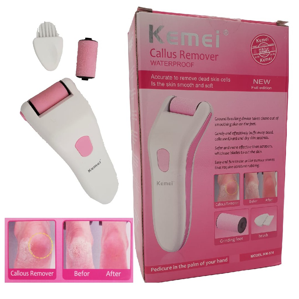 Kemei KM-374 callus remover/ Penghilang Kulit Kasar Kapalan pada kaki/ Menghalus Pembersih Tumit