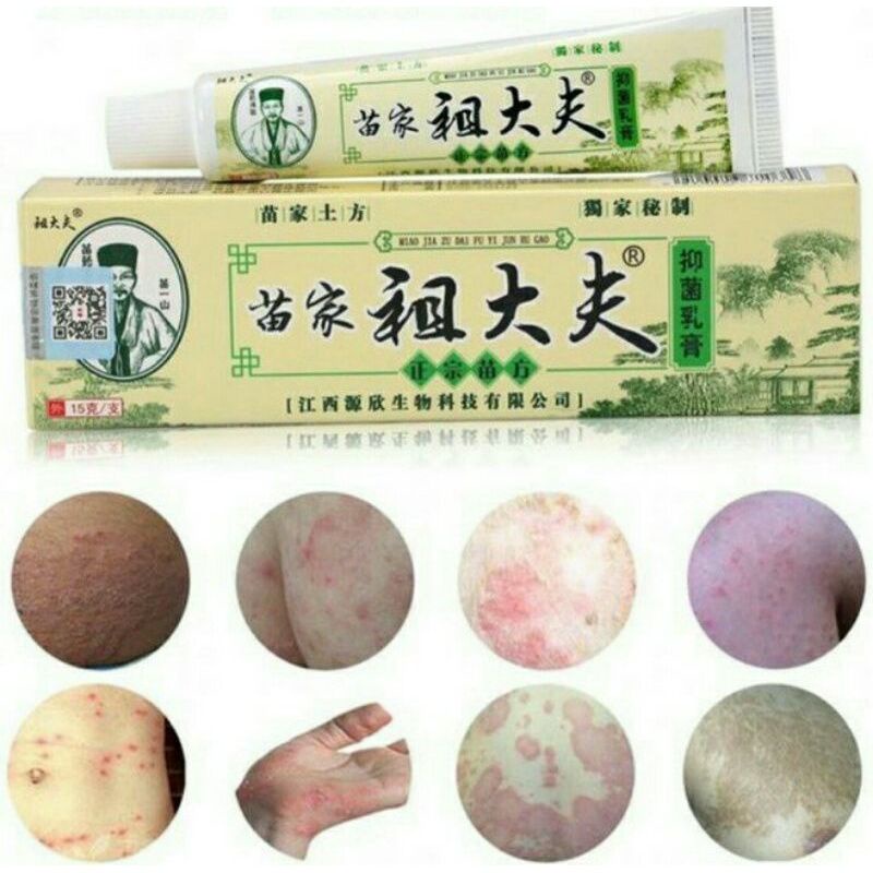 (COD) SALEP OBAT GATAL ALERGI 100% ORI SALEP HERBAL EKSIM JERAWAT JAMUR [[MANDARIN]]