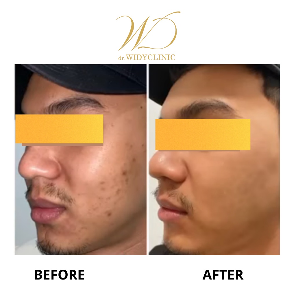 Whitening Day Cream dr Widy Clinic Krim Pagi/Siang Wajah Glowing Mencerahkan Memutihkan Wajah BPOM Halal MUI Cream Flek Melasma Bekas Jerawat Untuk Semua Jenis Kulit Formulasi Dokter