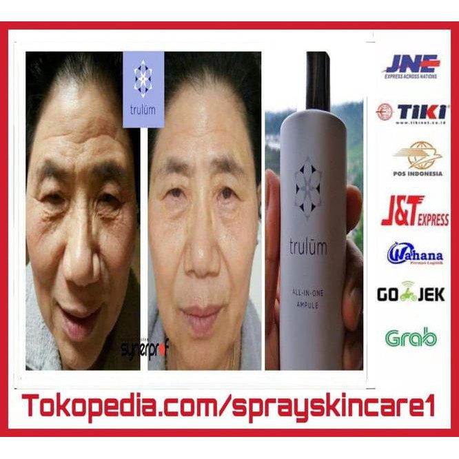 DNE7 ATASI KERIPUT DI WAJAH | ATASI KERIPUT - JERAWAT - FLEK HITAM RK07