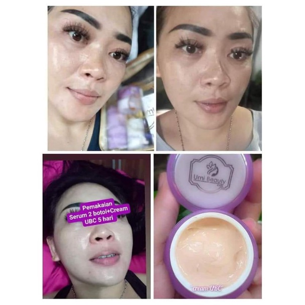 CREAM ECERAN UBC (UMI BEAUTY CARE) BY UMI ALFATIH ORIGINAL BPOM RI HALAL MUI