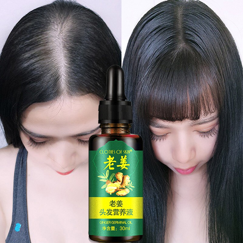 (BISA COD) (DALAM 7 HARI!!) Cairan Essence Penumbuh Rambut Minyak Penumbuh Rambut Obat Pria Wanita Botak Lebat Tebal Rontok Tipis Minyak Kemiri-1