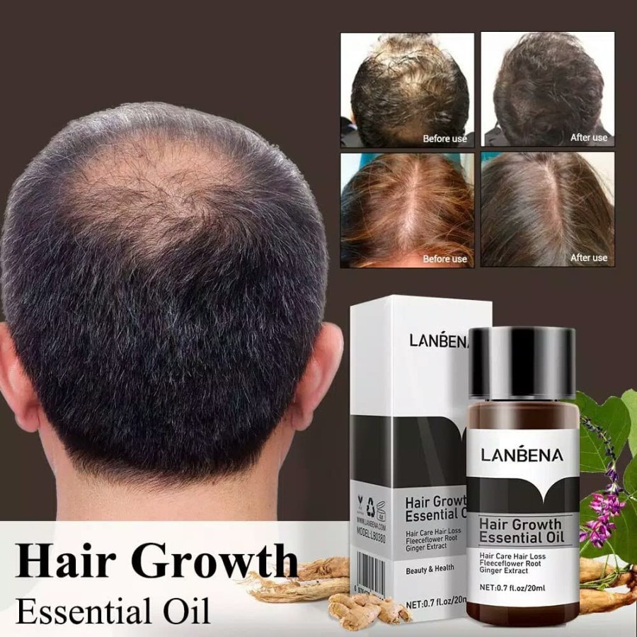 SHINE STAR - [ ORIGINAL 100% ] LANBENA HAIR GROWTH ESSENTIAL OIL / SERUM PENUMBUH RAMBUT BOTAK &amp; MENCEGAH KERONTOKKAN