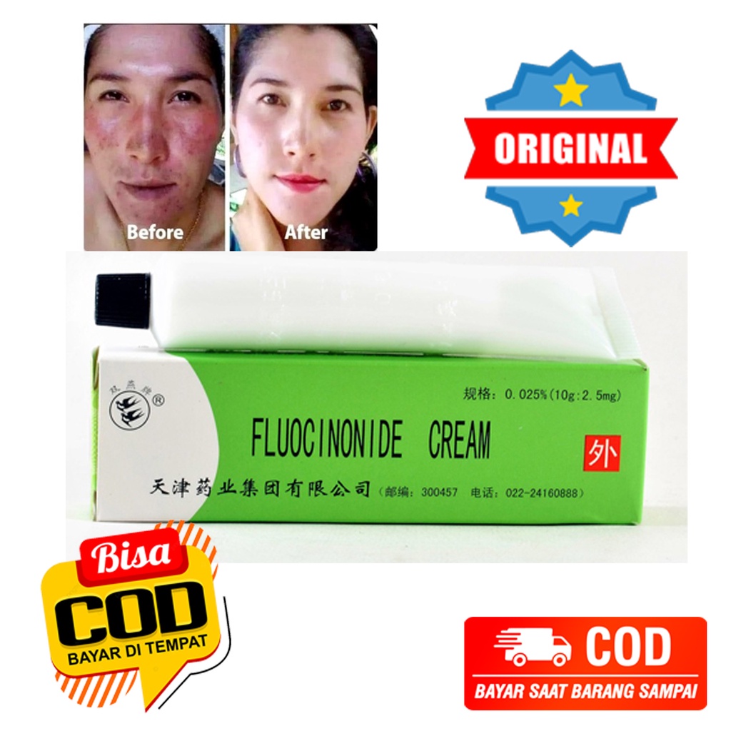 Salep walet cream wallet fluocinonide cream Menghilangkan jerawar, flek hitam, iritasi kemerahan pad