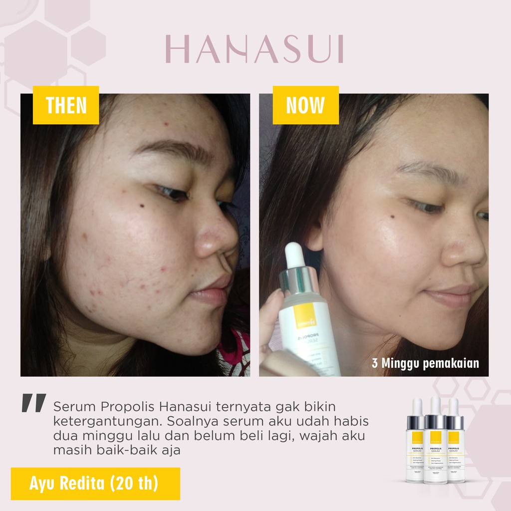 Hanasui Propolis Serum Hanasui Intense Treatment Serum