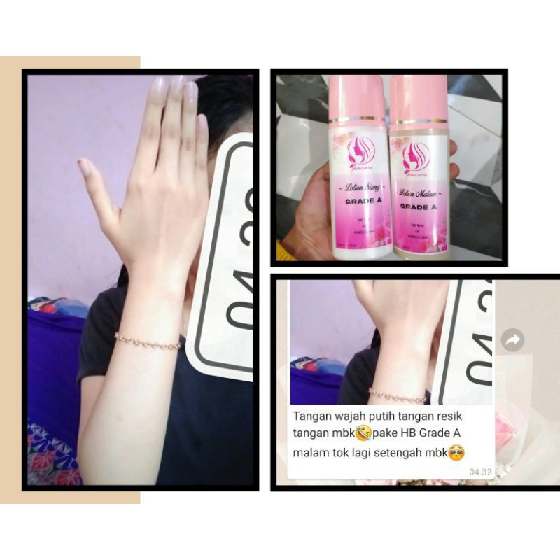 hb grade a /hb pink/hb whitening anti streatmak