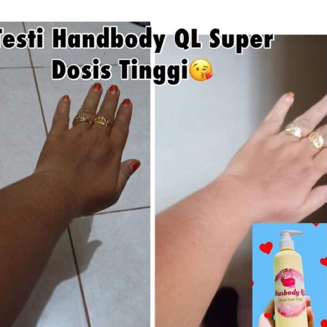 handbody lotion QL super dosis tinggi pemutih badan tangan kaki