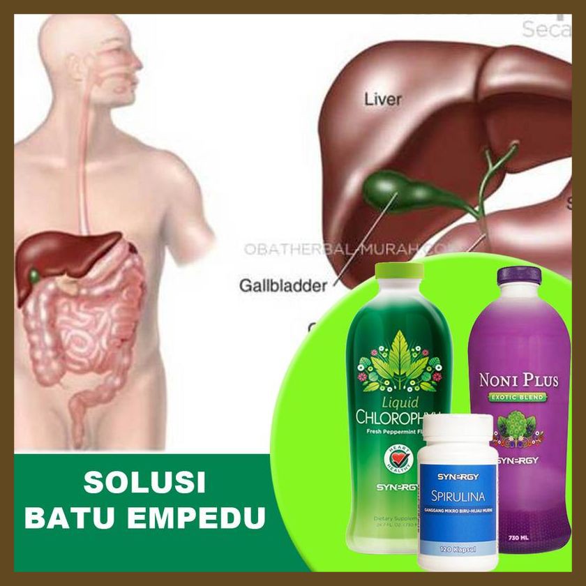 AMPUH Paket Herbal Obati Batu Empedu Plus Suplemen Kekebalan Tubuh Dewasa
