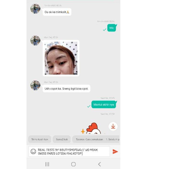 Skip Aja SWISS PARIS LOTION//PENGHILANG KUTIL//TAHI LALAT//JAMIN ORIGIONAL | TERPOPULER | VIRAL | TI