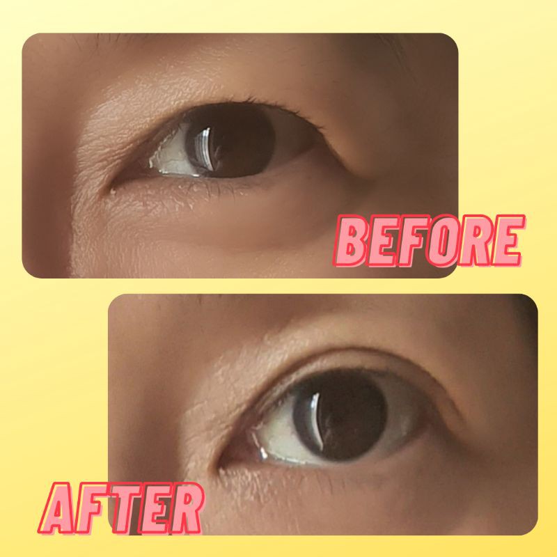 AIKYO MAGIC SKOT TAPE / EYELID TAPE / Skot Mata