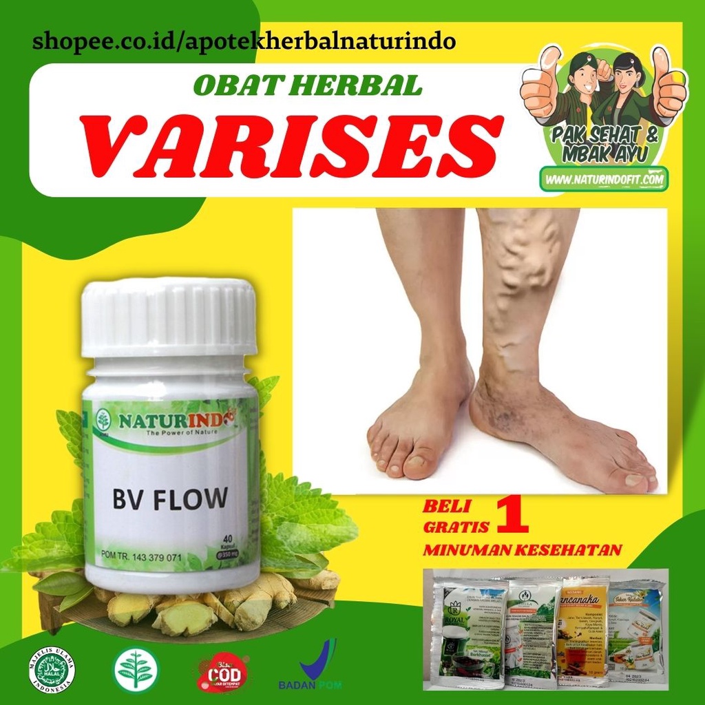 Obat Varises Di Kaki Dan Betis Paling Ampuh Obat Varikokel Bv Flow Obat Parises Kaki Paling Ampuh Ob