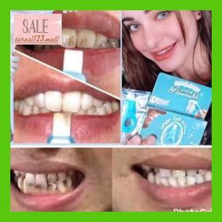 Igigputih- Murah Berkwalitas Teeth Cleaning Kit / Magic Sponge Teeth Whitening -Ori.
