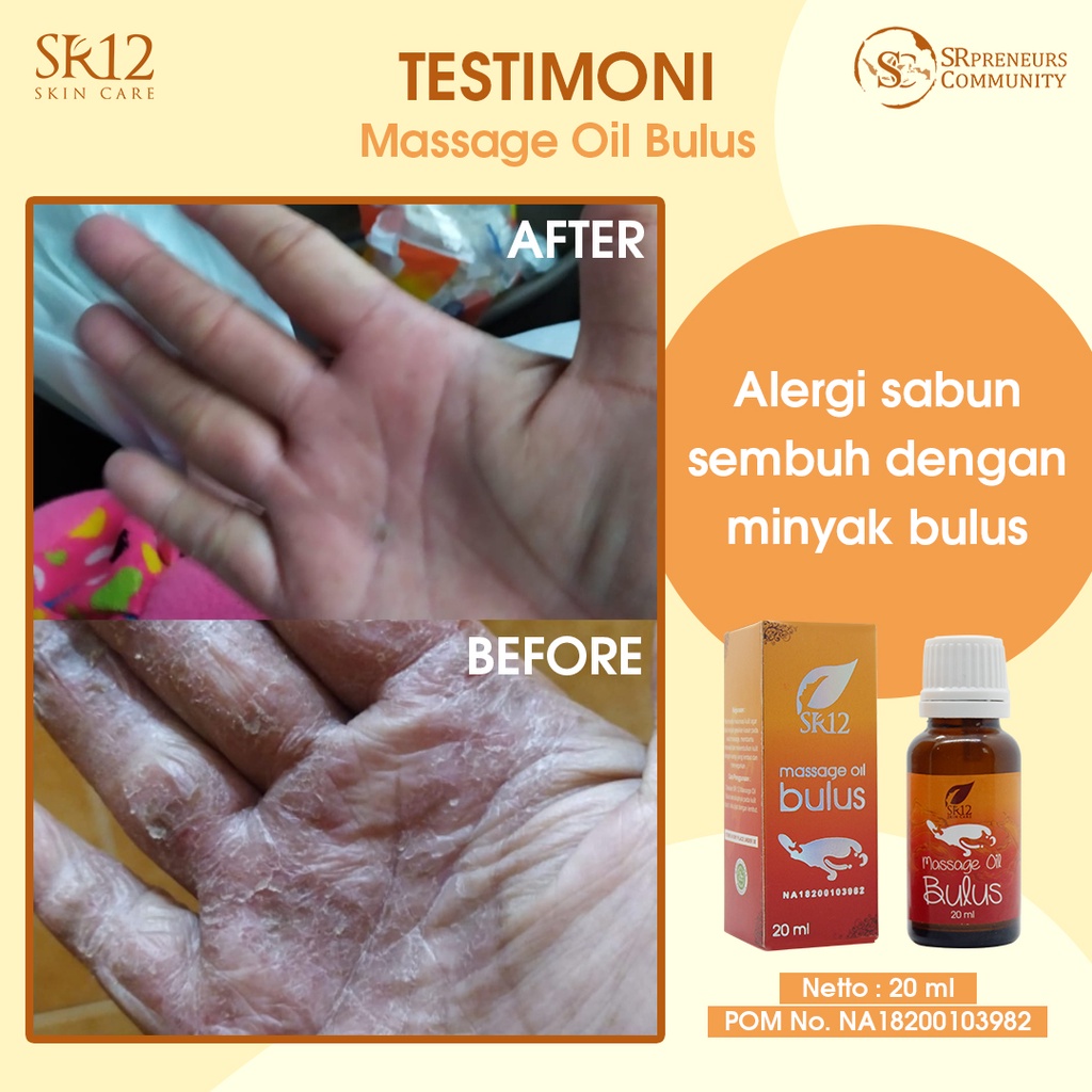 MINYAK BULUS ORIGINAL SR12 / MENGOBATI GATAL - GATAL / MENGHILANGKAN BEKAS LUKA / WANGI &amp; TIDAK BAU AMIS