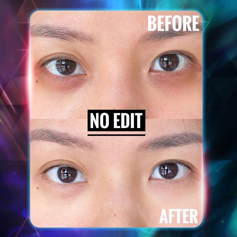 TRUEVE - Eye Gel Multi Peptide Glycogen Ultimate (10gr) Krim Mata, Penghilang Mata Panda