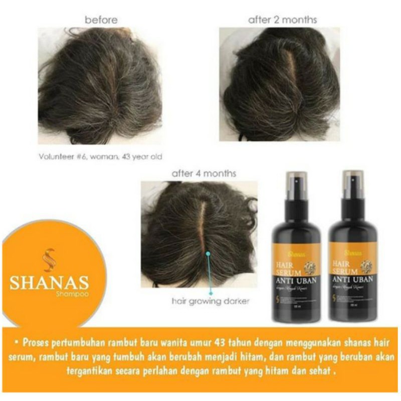 SHANAS HAIR SERUM ANTI UBAN 120 ML