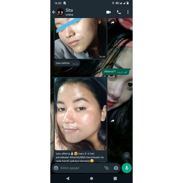 Skincare Ameera - Bimdav Skincare - krim lembut - ORI