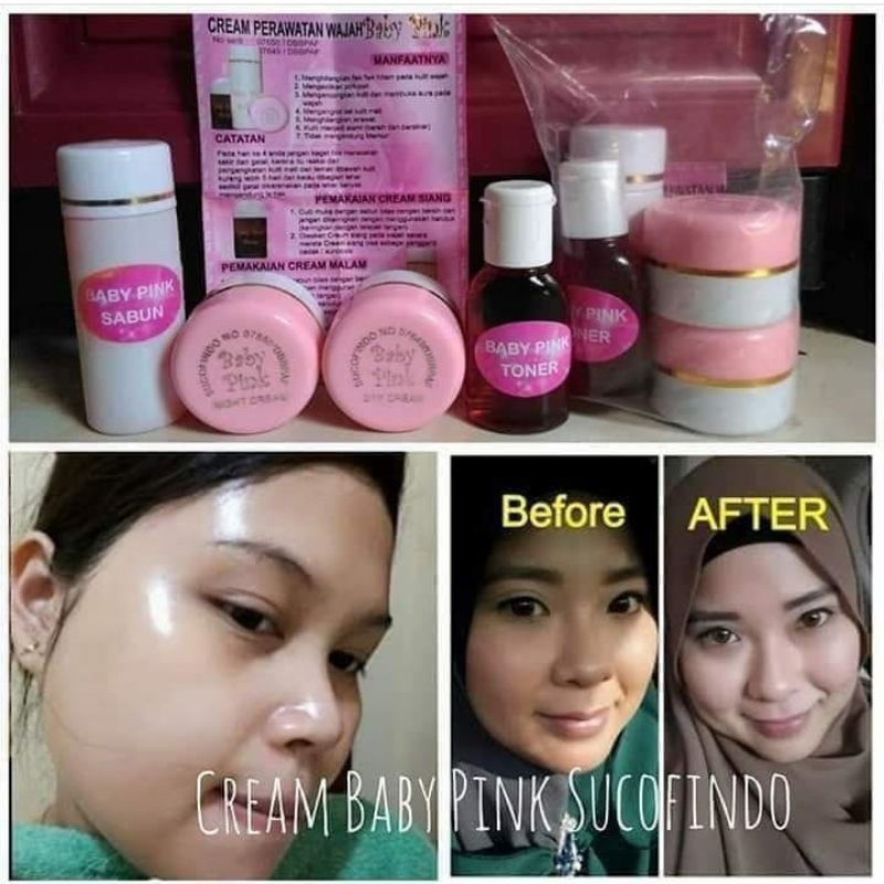 Paket Pemutih Wajah Glowing Untuk Kulit Susah Putih Baby Pink Scupindo Memutihkan Dan Mengglowingkan Kulit Susah Putih