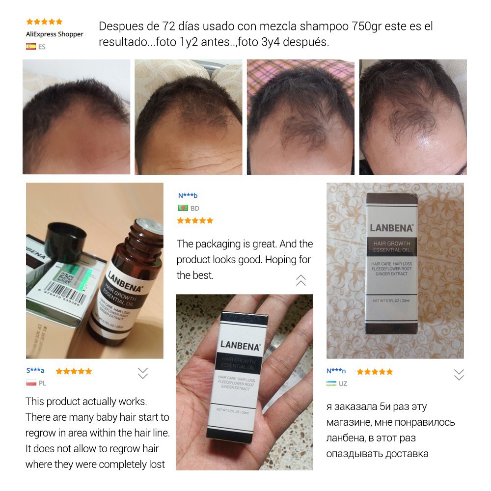 LANBENA HAIR SERUM PENUMBUH RAMBUT ANTI BOTAK 100% ORIGINAL GIRLSNEED77 Hair Growth Essential Oil