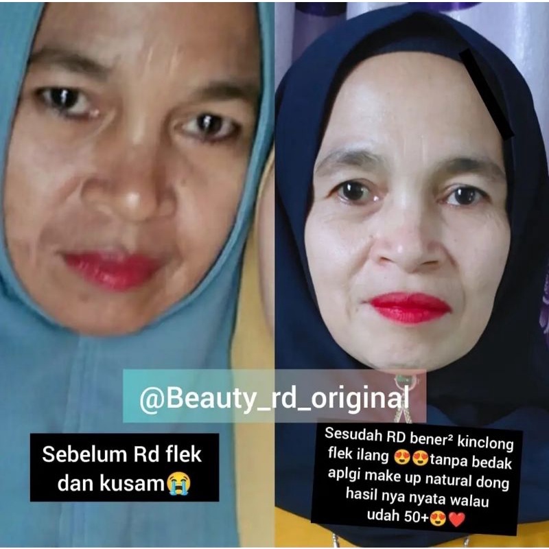 RED PREMIUM SKINCARE ORIGINAL BY ARNI / CREAM RD PREMIUM (BISA COD)