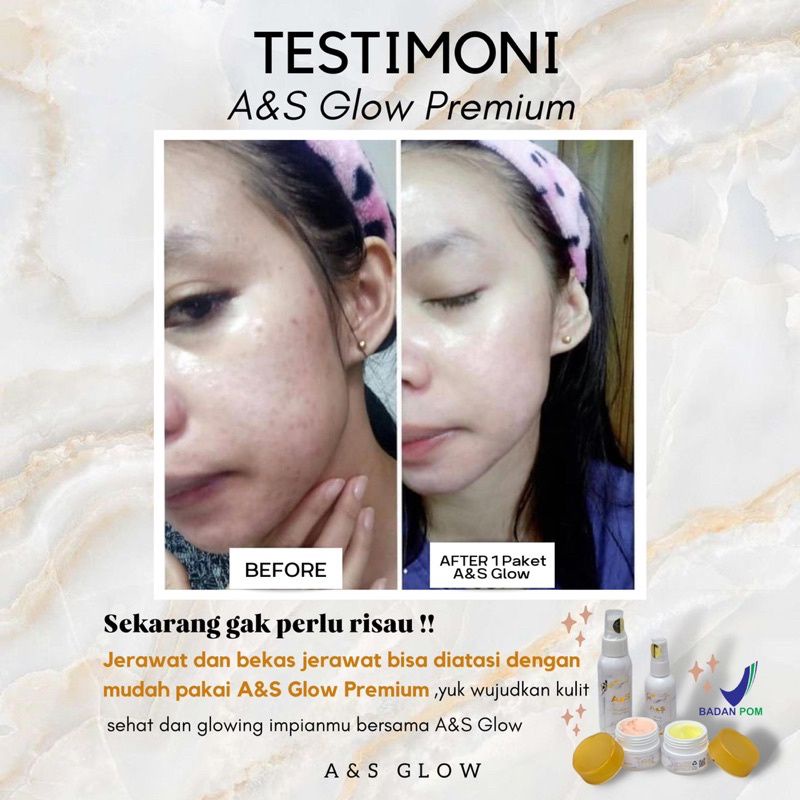 SUPER GLOWING  A&S GLOW PREMIUM | PAKET SKINCARE WAJAH