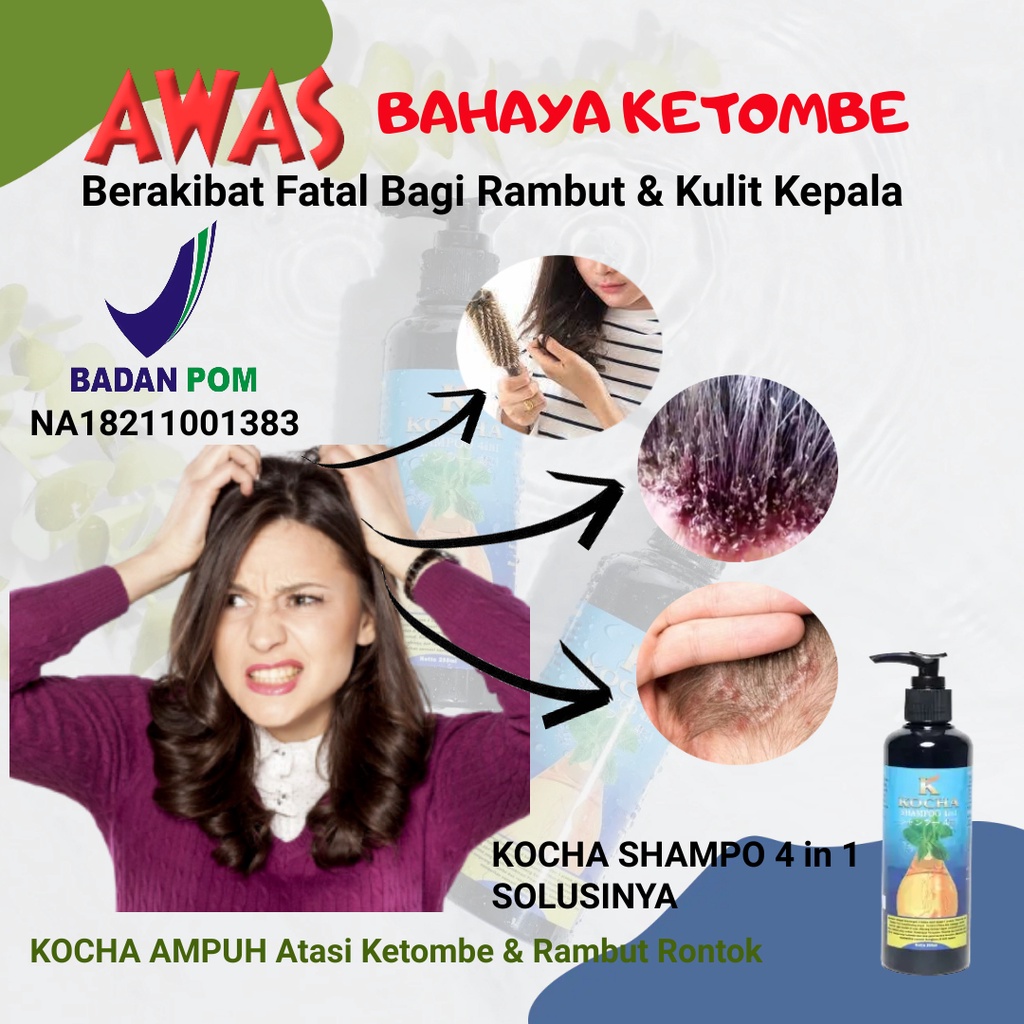 Shampoo Paling Ampuh Atasi Ketombe Dan Rambut Rontok A02-3