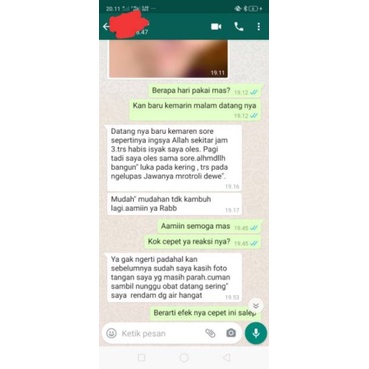 Cream Salep BL Murni Versi Original100% Tanpa Oplosan Salep Gatal Kutu Air Eksim Panu Kurap Ampuh