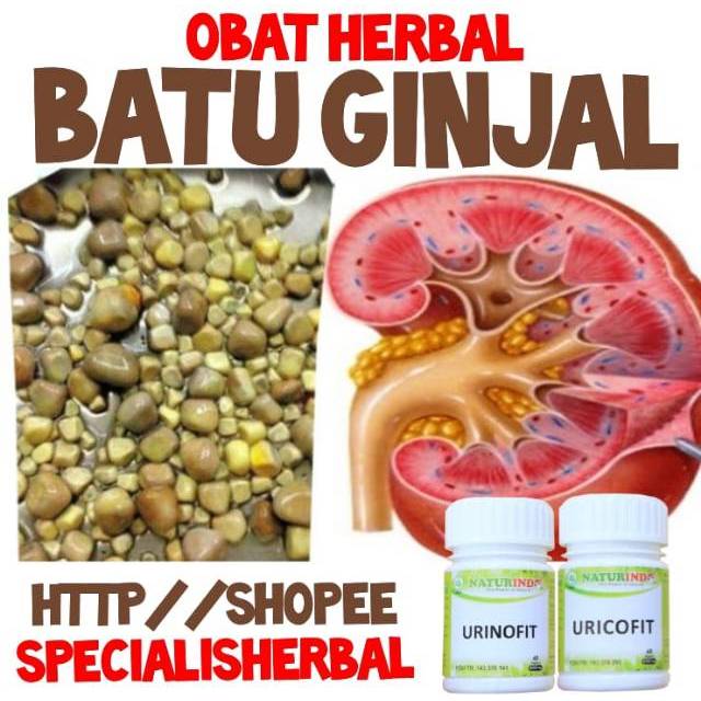 OBAT BATU GINJAL,GINJAL INFEKSI,PENGHANCUR BATU GINJAL HERBAL BATU GINJAL NATURINDO