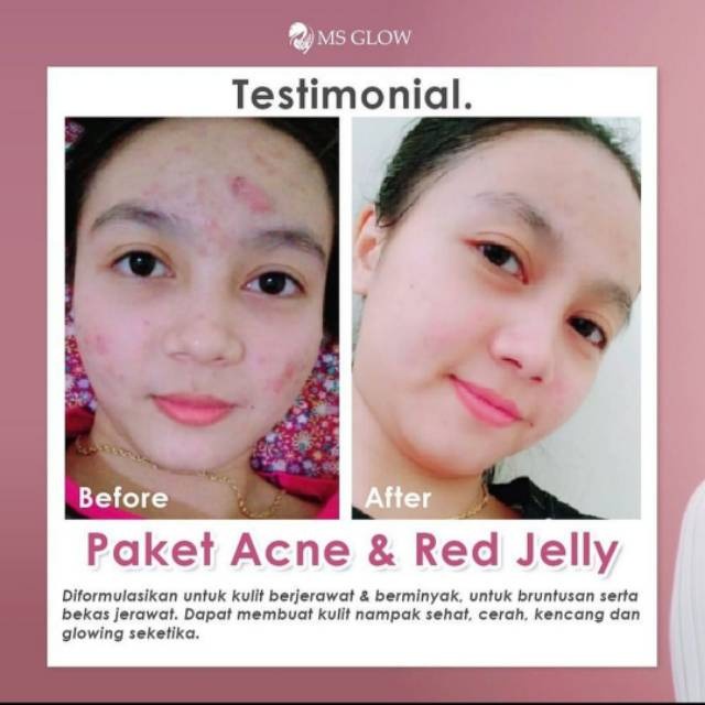 Ms Glow Red Jelly Extra Glowing / Flawless Glow Red Jelly Ms Glow / Sleeping Mask Ms Glow Original