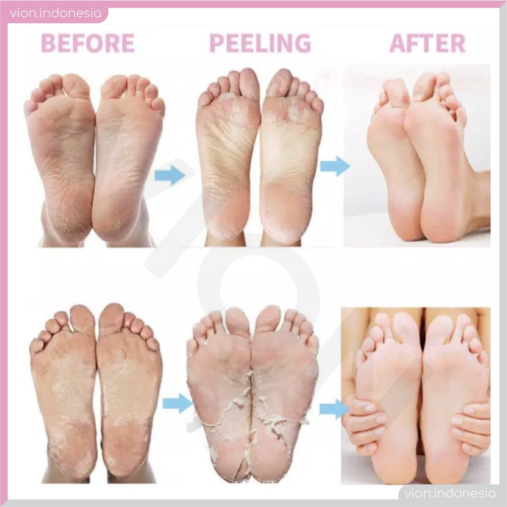 EFERO Foot Mask Lavender Exfoliating Masker Kaki Kelupas Kulit Mati