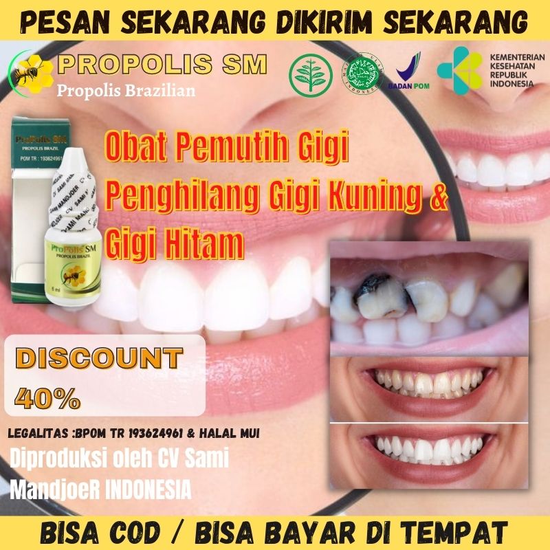 Obat Tetes / Obat Kumur / Pemutih Gigi / Obat Gigi Kuning / Menghilangkan Gigi Kuning / Pemutih Gigi