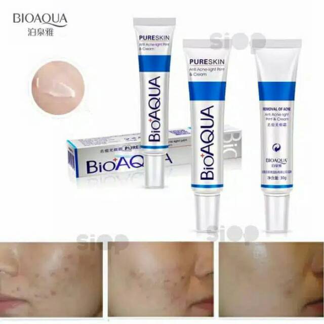 PENGHILANG JERAWAT BIOAQUA PURE SKIN REMOVAL 30 gr