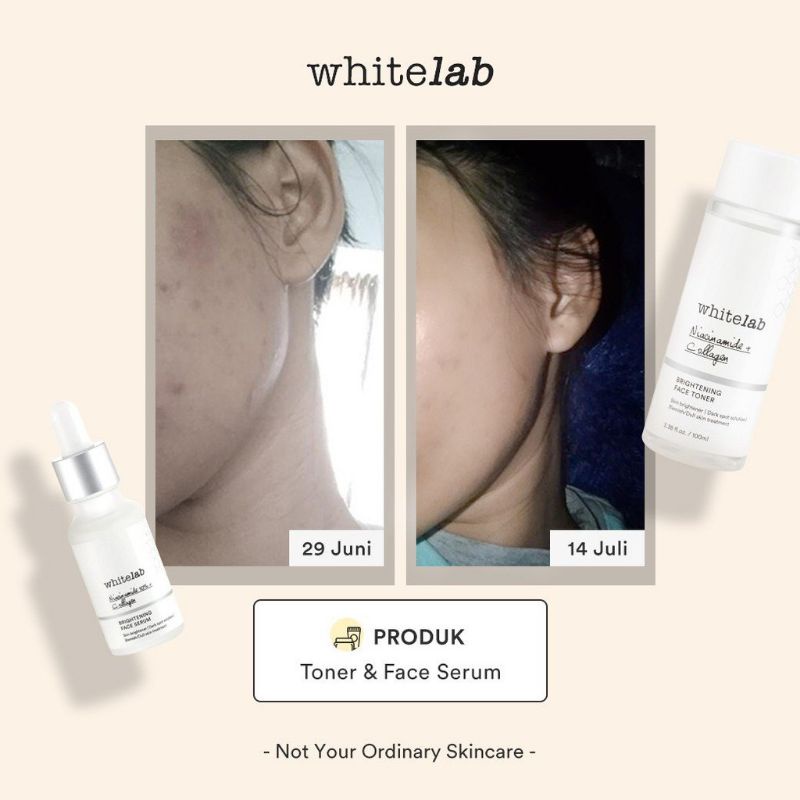 Whitelab Brightening Face Toner