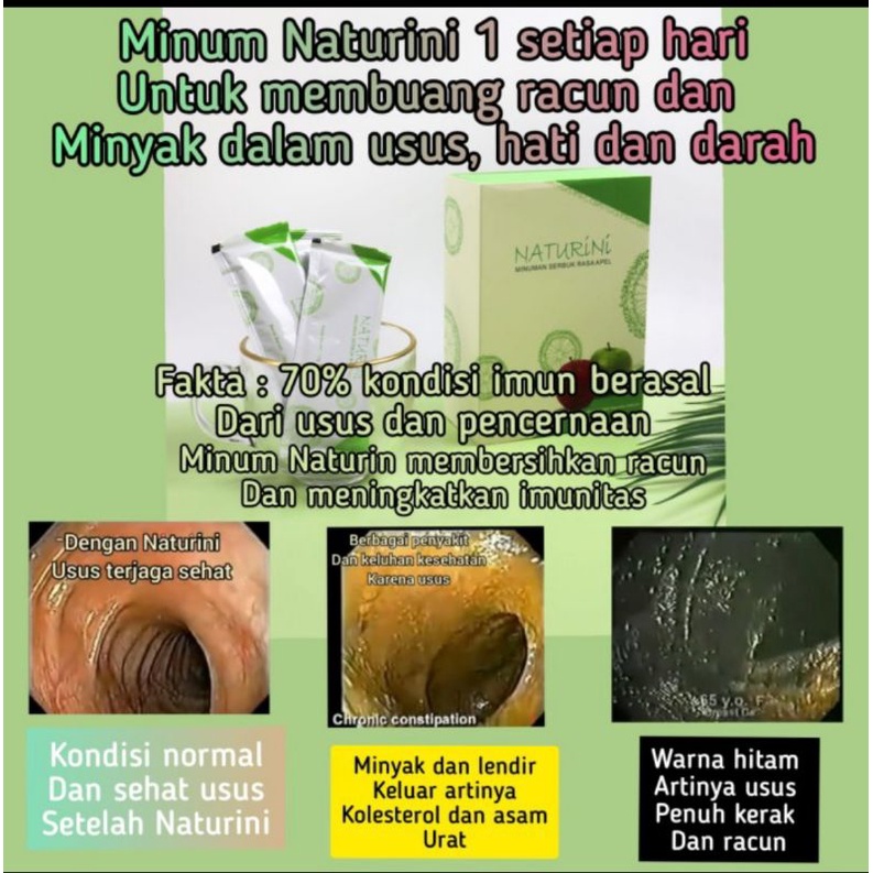 1 sachet Naturini Apel stemcell