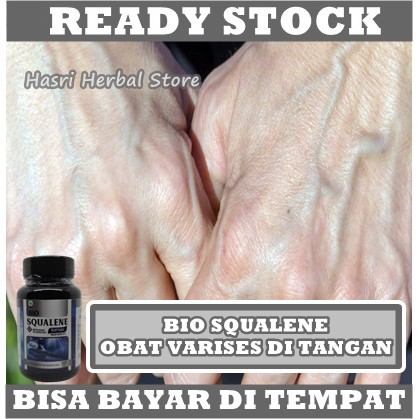 Obat Penghilang Varises - Herbal Penangkal Urat Menonjol - Herbal Varises Di Kaki Dan Tangan - Obat Alami Otot-otot Tegang - Obat Nyeri Kaki - Herbal Penuntas Kulit Betis Gatal - Keram pada Urat Membengkak Dengan Bio Squalene 100% Original