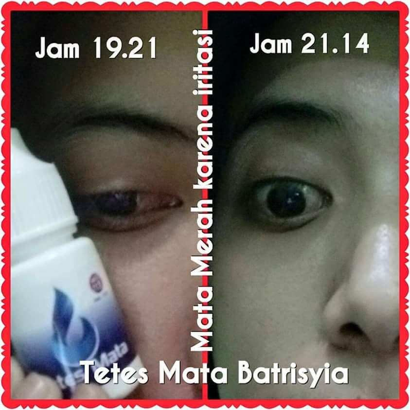 Obat Tetes Mata Batrisyia Herbal