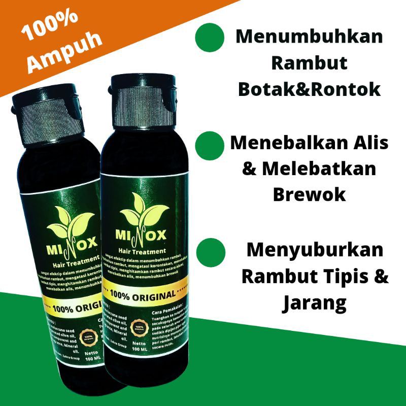 [Paket 2] MINOX Treatment Penumbuh Rambut Botak, Tipis &amp; Rontok Super Cepat Original 100 ML