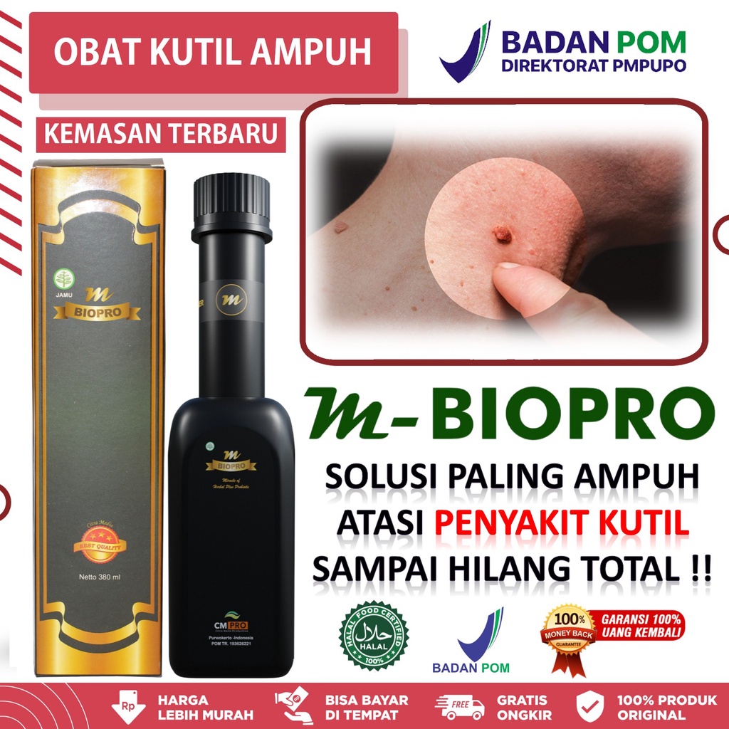 Obat Papiloma Penghilang Kutil Obat Kutil Di Leher Obat Kutil Tangan - Obat Herbal Mbiopro Original 