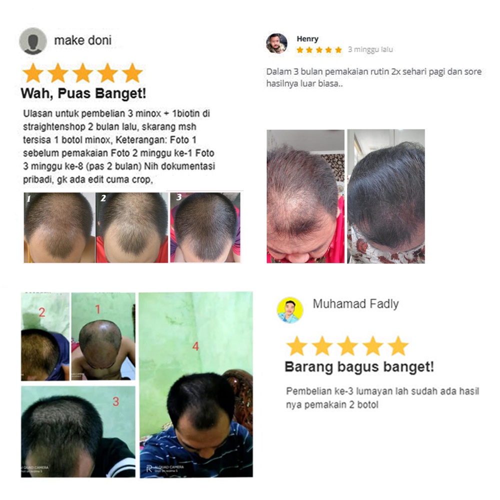 ( 𝟭𝟬𝟬% 𝐁𝐞𝐫𝐠𝐚𝐫𝐚𝐧𝐬𝐢 𝐎𝐫𝐢 ) Vithair Lush hair Serum 100Ml Solusi Untuk Mempertebal Menghitamkan Dan Membuat Rambut Berkilau Original Bpom