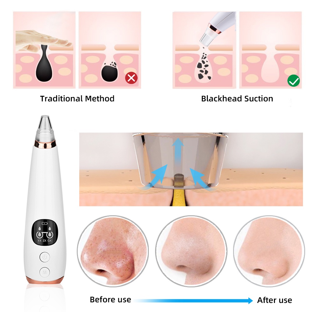 Blackhead Remover Komedo Pemanas Listrik Wajah Jerawat Pori Cleaner Vakum Komedo