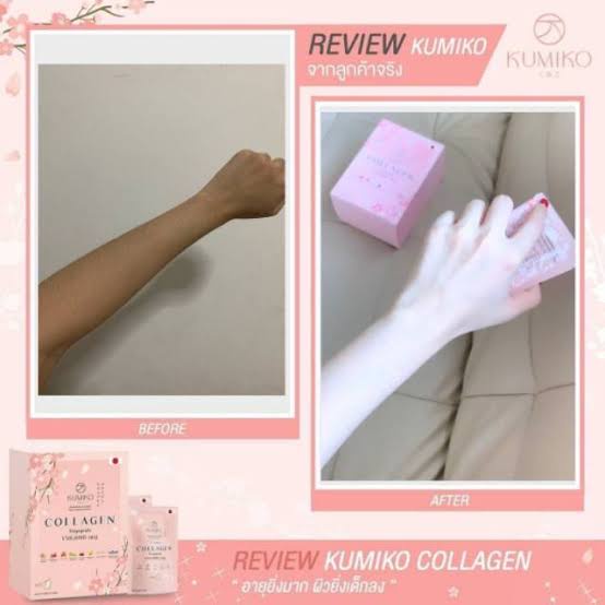 Kumiko Collagen Tripeptide 150.000mg/Minuman collagen/Collagen pemutih kulit/pemutih wajah/pemutih badan/anti jerawat